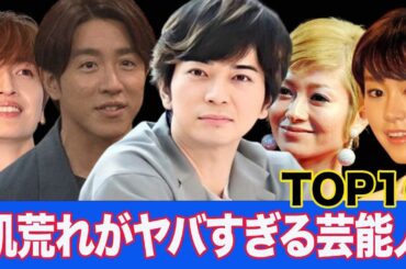 肌荒れがヤバすぎる芸能人衝撃ランキングTOP16！地デジに対応できない汚肌芸能人は…