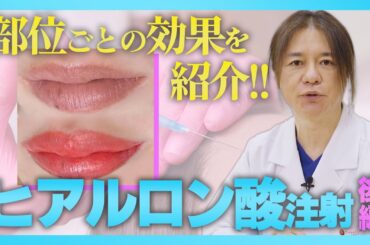 【ヒアルロン酸注射】唇、ほうれい線、涙袋！注射する部位ごとの効果を紹介！！【後編】